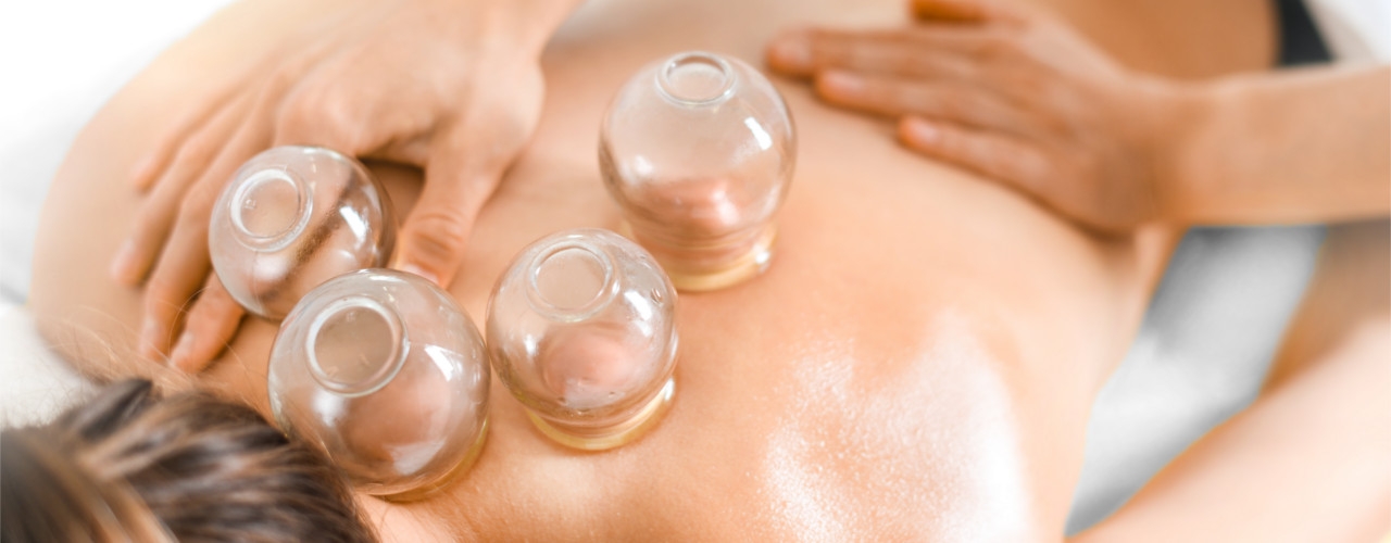 cupping-Rehab-Partners-Albertville-Centre-AL
